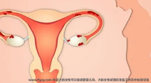 年纪大的女性可以做代孕吗，大龄女性试管前准备工作及件检查项目