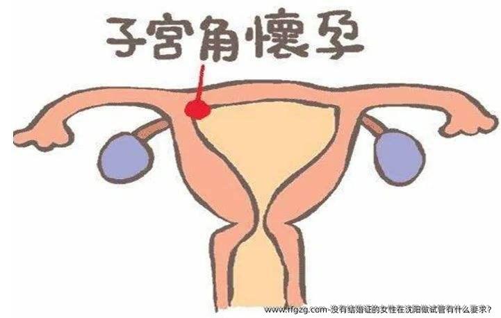 没有结婚证的女性在沈阳做试管有什么要求？