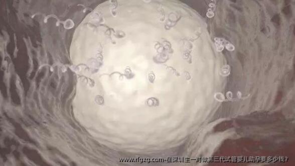 在深圳生一对做第三代代孕助孕要多少钱？